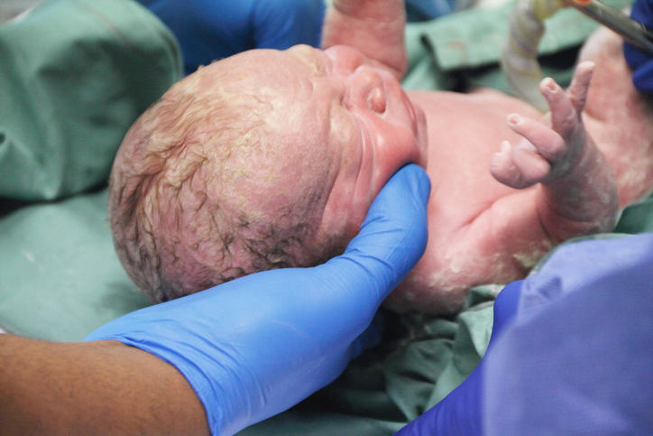Baby forløses ved kejsersnit.