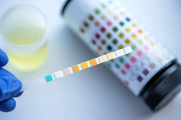 Urinprøve - kontrol hos jordemoder og læge for protein og sukker i urinen, når du er gravid