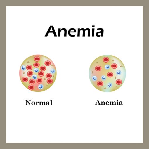 anæmi