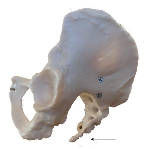 halebenet