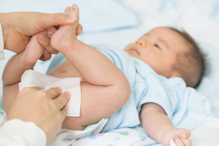Baby på puslebord med modermælks gulsot